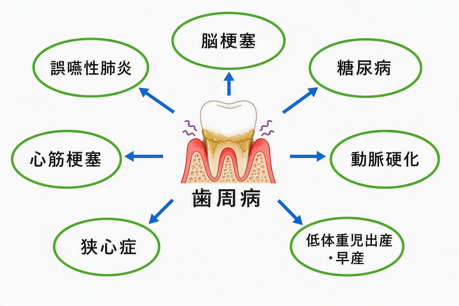 歯周病と全身疾患との関連性