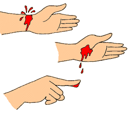 手首、手のひら、指先それぞれの出血イメージのイラスト