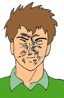 やけどをしている男性の顔のイラスト